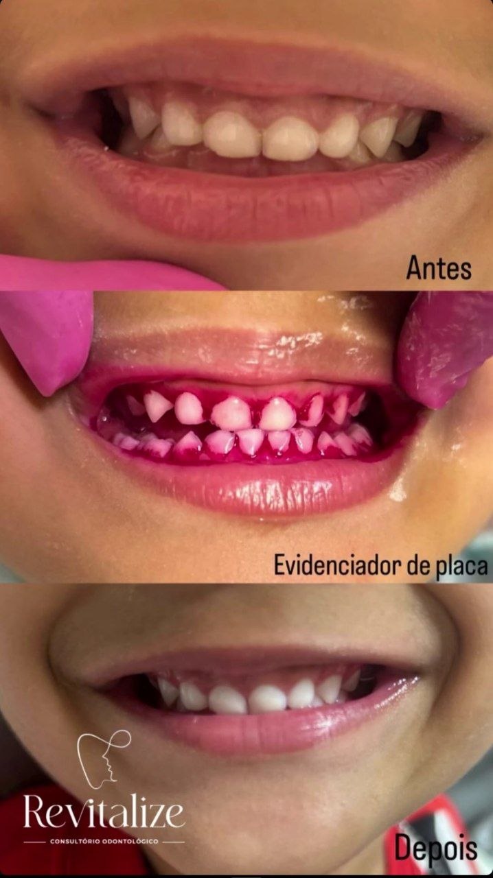Antes e depois: limpeza infantil